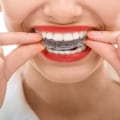Invisalign Treatment: No Age Restrictions - Get the Perfect Smile at Any Age