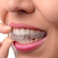 What Foods and Drinks Should I Avoid While Wearing Invisalign Aligners?