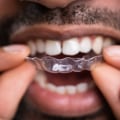 How Often Should I Visit the Dentist During My Invisalign Treatment?