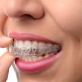 What Happens if You Don't Wear Your Invisalign Aligners for the Recommended Time?