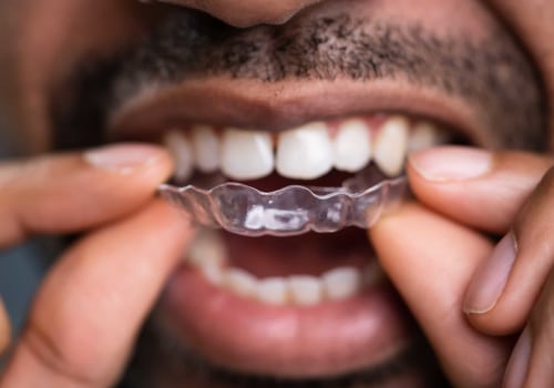 How Often Should I Visit the Dentist During My Invisalign Treatment?