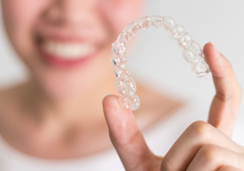 The Ultimate Guide to Cleaning Invisalign Aligners
