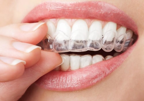 What Activities Should I Avoid While Wearing Invisalign Aligners?