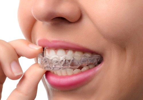 Can I Eat and Drink While Wearing My Invisalign Aligners?