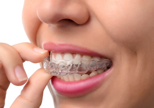Does Invisalign Work Without Tooth Extraction? - An Expert's Perspective